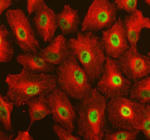 Immunofluorescent staining of RAI1 using anti-RAI1 antibody (green) and anti-Beta Tubulin antibody (red). RAI1 was detected in an immunocytochemical section of cells. Enzyme antigen retrieval was performed using IHC enzyme antigen retrieval reagent for 15 mins. The cells were blocked with 10% goat serum. And then incubated with 5 ug/ml rabbit anti-RAI1 antibody and mouse anti-Beta Tubulin antibody overnight at 4oC. DyLight 488 Conjugated Goat Anti-Rabbit IgG and Cy3 Conjugated Goat Anti-Mouse IgG were used as secondary antibody at 1:500 dilution and incubated for 30 minutes at 37oC. Visualize using a fluorescence microscope and filter sets appropriate for the label used.