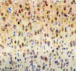 Immunohistochemical staining of NCDN using anti-NCDN antibody. NCDN was detected in a paraffin-embedded section of rat brain tissue. Heat mediated antigen retrieval was performed in EDTA buffer (pH 8.0, epitope retrieval solution). The tissue section was blocked with 10% goat serum. The tissue section was then incubated with 2 ug/ml rabbit anti-NCDN antibody overnight at 4oC. Peroxidase Conjugated Goat Anti-rabbit IgG was used as secondary antibody and incubated for 30 minutes at 37oC. The tissue section was developed using an HRP secondary and DAB substrate.