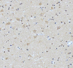 Immunohistochemical staining of NCDN using anti-NCDN antibody. NCDN was detected in a paraffin-embedded section of human brain tissue. Heat mediated antigen retrieval was performed in EDTA buffer (pH 8.0, epitope retrieval solution). The tissue section was blocked with 10% goat serum. The tissue section was then incubated with 2 ug/ml rabbit anti-NCDN antibody overnight at 4oC. Peroxidase Conjugated Goat Anti-rabbit IgG was used as secondary antibody and incubated for 30 minutes at 37oC. The tissue section was developed using an HRP secondary and DAB substrate.