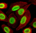 Immunofluorescent staining of TMPO using anti-TMPO antibody (green) and anti-Alpha Tubulin antibody (red). TMPO was detected in an immunocytochemical section of SiHa cells. Enzyme antigen retrieval was performed using IHC enzyme antigen retrieval reagent for 15 mins. The cells were blocked with 10% goat serum. And then incubated with 5 ug/ml rabbit anti-TMPO antibody and mouse anti-Beta Tubulin antibody overnight at 4oC. DyLight 488 Conjugated Goat Anti-Rabbit IgG and Cy3 Conjugated Goat Anti-Mouse IgG were used as secondary antibody at 1:500 dilution and incubated for 30 minutes at 37oC. Visualize using a fluorescence microscope and filter sets appropriate for the label used.