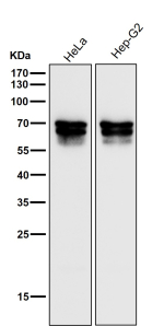 All lanes use the PICALM antibody at 1:3000 dilution for 1 hour at room temperature. Western blot analysis of PICALM using anti-PICALM antibody. A triplet is observed between ~60 and 71 kDa, consistent with reported isoforms and phosphorylation variants of PICALM that arise from alternative splicing and post-translational modification.