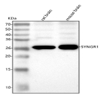 Western blot analysis of Synaptogyrin 1 using anti-SYNGR1 antibody. Lane 1: rat brain tissue lysates, Lane 2: mouse brain tissue lysates. After electrophoresis, proteins were transferred to a nitrocellulose membrane at 150 mA for 50-90 minutes. Blocked the membrane with 5% non-fat milk/TBS for 1.5 hour at RT. The membrane was incubated with rabbit anti-SYNGR1 antibody at 0.5 ug/ml overnight at 4oC, then washed with TBS-0.1%Tween 3 times with 5 minutes each and probed with a goat anti-rabbit IgG-HRP secondary antibody at a dilution of 1:5000 for 1.5 hour at RT. The signal was developed using enhanced chemiluminescent. The expected molecular weight of Synaptogyrin 1 is at 25 kDa.