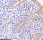 Immunohistochemical staining of SASS6 using anti-SASS6 antibody. SASS6 was detected in a paraffin-embedded section of human appendiceal carcinoid tissue. Heat mediated antigen retrieval was performed in EDTA buffer (pH 8.0, epitope retrieval solution). The tissue section was blocked with 10% goat serum. The tissue section was then incubated with 2 ug/ml rabbit anti-SASS6 antibody overnight at 4oC. Peroxidase Conjugated Goat Anti-rabbit IgG was used as secondary antibody and incubated for 30 minutes at 37oC. The tissue section was developed using an HRP secondary and DAB substrate.