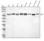 Western blot analysis of SASS6 using anti-SASS6 antibody. Lane 1: human Hela whole cell lysates, Lane 2: human 293T whole cell lysates, Lane 3: human MCF-7 whole cell lysates, Lane 4: human K562 whole cell lysates, Lane 5: rat testis tissue lysates, Lane 6: rat brain tissue lysates, Lane 7: mouse testis tissue lysates, Lane 8: mouse brain tissue lysates. After electrophoresis, proteins were transferred to a nitrocellulose membrane at 150 mA for 50-90 minutes. Blocked the membrane with 5% non-fat milk/TBS for 1.5 hour at RT. The membrane was incubated with rabbit anti-SASS6 antibody at 0.5 ug/ml overnight at 4oC, then washed with TBS-0.1%Tween 3 times with 5 minutes each and probed with a goat anti-rabbit IgG-HRP secondary antibody at a dilution of 1:5000 for 1.5 hour at RT. The signal was developed using enhanced chemiluminescent. An ~74 kDa doublet is observed, consistent with reported phosphorylation-dependent mobility differences for SASS6 on SDS-PAGE.
