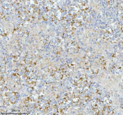 Immunohistochemical staining of SASS6 using anti-SASS6 antibody. SASS6 was detected in a paraffin-embedded section of human testicular seminoma tissue. Heat mediated antigen retrieval was performed in EDTA buffer (pH 8.0, epitope retrieval solution). The tissue section was blocked with 10% goat serum. The tissue section was then incubated with 2 ug/ml rabbit anti-SASS6 antibody overnight at 4oC. Peroxidase Conjugated Goat Anti-rabbit IgG was used as secondary antibody and incubated for 30 minutes at 37oC. The tissue section was developed using an HRP secondary and DAB substrate.