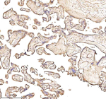 Immunohistochemical staining of PTCD1 using anti-PTCD1 antibody. PTCD1 was detected in a paraffin-embedded section of human placenta tissue. Heat mediated antigen retrieval was performed in EDTA buffer (pH 8.0, epitope retrieval solution). The tissue section was blocked with 10% goat serum. The tissue section was then incubated with 2 ug/ml rabbit anti-PTCD1 antibody overnight at 4oC. Peroxidase Conjugated Goat Anti-rabbit IgG was used as secondary antibody and incubated for 30 minutes at 37oC. The tissue section was developed using an HRP secondary and DAB substrate.