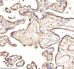 Immunohistochemical staining of PTCD1 using anti-PTCD1 antibody. PTCD1 was detected in a paraffin-embedded section of human placenta tissue. Heat mediated antigen retrieval was performed in EDTA buffer (pH 8.0, epitope retrieval solution). The tissue section was blocked with 10% goat serum. The tissue section was then incubated with 2 ug/ml rabbit anti-PTCD1 antibody overnight at 4oC. Peroxidase Conjugated Goat Anti-rabbit IgG was used as secondary antibody and incubated for 30 minutes at 37oC. The tissue section was developed using an HRP secondary and DAB substrate.