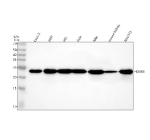 Western blot analysis of HOXB6 using anti-HOXB6 antibody. Electrophoresis was performed on a 12% SDS-PAGE gel at 80V (Stacking gel) / 120V (Resolving gel) for 2 hours. Lane 1: human Caco-2 whole cell lysates, Lane 2: human 293T whole cell lysates, Lane 3: human HEL whole cell lysates, Lane 4: human Hela whole cell lysates, Lane 5: rat NRK whole cell lysates, Lane 6: mouse kidney tissue lysates, Lane 7: mouse NIH/3T3 whole cell lysates. After electrophoresis, proteins were transferred to a nitrocellulose membrane at 150 mA for 50-90 minutes. Blocked the membrane with 5% non-fat milk/TBS for 1.5 hour at RT. The membrane was incubated with rabbit anti-HOXB6 antibody at 0.5 ug/ml overnight at 4oC, then washed with TBS-0.1%Tween 3 times with 5 minutes each and probed with a goat anti-rabbit IgG-HRP secondary antibody at a dilution of 1:5000 for 1.5 hour at RT. The signal was developed using an ECL Plus Western Blotting Substrate. A specific band was detected for HOXB6 at approximately 25 kDa. The expected molecular weight of HOXB6 is ~25 kDa.