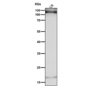 Rat C6 cell lysate tested with the HIF1A antibody at 1:1000 dilution for 1 hour at room temperature. Predicted molecular weight ~110 kDa, commonly observed at 100-120 kDa.