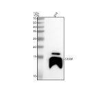 Western blot analysis of S100P using anti-S100P antibody. Lane 1: human RT4 whole cell lysates. After electrophoresis, proteins were transferred to a nitrocellulose membrane at 150 mA for 50-90 minutes. Blocked the membrane with 5% non-fat milk/TBS for 1.5 hour at RT. The membrane was incubated with rabbit anti-S100P antibody at 0.5 ug/ml overnight at 4oC, then washed with TBS-0.1%Tween 3 times with 5 minutes each and probed with a goat anti-rabbit IgG-HRP secondary antibody at a dilution of 1:5000 for 1.5 hour at RT. The signal was developed using enhanced chemiluminescent. A predominant band is detected at ~14 kDa, which is typical for S100P due to anomalous SDS-PAGE mobility of EF-hand S100 proteins relative to the ~10 kDa calculated mass.