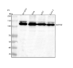 Western blot analysis of INPP5F using anti-INPP5F antibody. Lane 1: human SH-SY5Y whole cell lysates, Lane 2: human SIHA whole cell lysates, Lane 3: human U251 whole cell lysates, Lane 4: human Caco-2 whole cell lysates. After electrophoresis, proteins were transferred to a nitrocellulose membrane at 150 mA for 50-90 minutes. Blocked the membrane with 5% non-fat milk/TBS for 1.5 hour at RT. The membrane was incubated with rabbit anti-INPP5F antibody at 0.5 ug/ml overnight at 4oC, then washed with TBS-0.1%Tween 3 times with 5 minutes each and probed with a goat anti-rabbit IgG-HRP secondary antibody at a dilution of 1:5000 for 1.5 hour at RT. The signal was developed using enhanced chemiluminescent. A predominant band is detected at ~128 kDa with a faint higher-migrating species, consistent with reported post-translationally modified forms (e.g., phosphorylated or mono-ubiquitinated INPP5F).