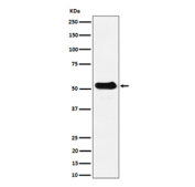 Western blot analysis of alpha Tubulin expression in mouse spleen cell lysate using Alpha Tubulin (acetyl K40) antibody. Predicted molecular weight ~50 kDa.