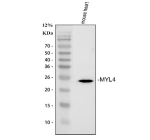 Western blot analysis of MYL4 using anti-MYL4 antibody. Lane 1: mouse heart tissue lysates. After electrophoresis, proteins were transferred to a nitrocellulose membrane at 150 mA for 50-90 minutes. Blocked the membrane with 5% non-fat milk/TBS for 1.5 hour at RT. The membrane was incubated with rabbit anti-MYL4 antibody at 0.5 ug/ml overnight at 4oC, then washed with TBS-0.1%Tween 3 times with 5 minutes each and probed with a goat anti-rabbit IgG-HRP secondary antibody at a dilution of 1:5000 for 1.5 hour at RT. The signal was developed using enhanced chemiluminescent. The expected molecular weight of MYL4 is ~22 kDa.