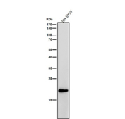 Human SH-SY5Y cell lysate tested with CRP antibody at 1:1000 dilution for 1 hour at room temperature. A predominant band is detected at ~17 kDa, consistent with proteolytically processed CRP fragments; other antibodies may detect the ~23-26 kDa monomer under the same conditions.