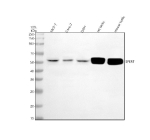 Western blot analysis of CBY2 using anti-CBY2 antibody. Electrophoresis was performed on a 10% SDS-PAGE gel at 80V (Stacking gel) / 120V (Resolving gel) for 2 hours. Lane 1: human MCF-7 whole cell lysates, Lane 2: human Caco-2 whole cell lysates, Lane 3: human U251 whole cell lysates, Lane 4: rat testis tissue lysates, Lane 5: mouse testis tissue lysates. After electrophoresis, proteins were transferred to a nitrocellulose membrane at 150 mA for 50-90 minutes. Blocked the membrane with 5% non-fat milk/TBS for 1.5 hour at RT. The membrane was incubated with rabbit anti-CBY2 antibody at 0.5 ug/ml overnight at 4oC, then washed with TBS-0.1%Tween 3 times with 5 minutes each and probed with a goat anti-rabbit IgG-HRP secondary antibody at a dilution of 1:5000 for 1.5 hour at RT. The signal was developed using an ECL Plus Western Blotting Substrate. A specific band was detected for CBY2 at approximately 52 kDa. The expected molecular weight of CBY2 is ~52 kDa.