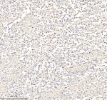 Immunohistochemical staining of Annexin using anti-Annexin antibody. Annexin was detected in a paraffin-embedded section of human testis cancer tissue. Heat mediated antigen retrieval was performed in EDTA buffer (pH 8.0, epitope retrieval solution). The tissue section was blocked with 10% goat serum. The tissue section was then incubated with 2 ug/ml rabbit anti-Annexin antibody overnight at 4oC. Peroxidase Conjugated Goat Anti-rabbit IgG was used as secondary antibody and incubated for 30 minutes at 37oC. The tissue section was developed using an HRP secondary and DAB substrate.