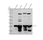 Western blot analysis of SULT1C2 using anti-SULT1C2 antibody. Electrophoresis was performed on a 10% SDS-PAGE gel at 80V (Stacking gel) / 120V (Resolving gel) for 2 hours. Lane 1: rat stomach tissue lysates, Lane 2: rat kidney tissue lysates, Lane 3: mouse stomach tissue lysates, Lane 4: mouse kidney tissue lysates. After electrophoresis, proteins were transferred to a nitrocellulose membrane at 150 mA for 50-90 minutes. Blocked the membrane with 5% non-fat milk/TBS for 1.5 hour at RT. The membrane was incubated with rabbit anti-SULT1C2 antibody at 0.5 ug/ml overnight at 4oC, then washed with TBS-0.1%Tween 3 times with 5 minutes each and probed with a goat anti-rabbit IgG-HRP secondary antibody at a dilution of 1:5000 for 1.5 hour at RT. The signal was developed using an ECL Plus Western Blotting Substrate. The expected ~35 kDa band is detected as a strong signal around 37 kDa, consistent with post-translationally modified SULT1C2. Additional minor bands at ~28-30 kDa and ~50 kDa likely represent truncated or aggregated forms commonly observed for cytosolic sulfotransferases.