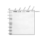 Western blot analysis of GARNL1/RALGAPA1 using anti-RALGAPA1 antibody. Electrophoresis was performed on a 8% SDS-PAGE gel at 80V (Stacking gel) / 120V (Resolving gel) for 2 hours. Lane 1: human 293T whole cell lysates, Lane 2: human HepG2 whole cell lysates, Lane 3: rat brain tissue lysates, Lane 4: mouse brain tissue lysates, Lane 5: mouse Neuro-2a whole cell lysates. After electrophoresis, proteins were transferred to a nitrocellulose membrane at 150 mA for 50-90 minutes. Blocked the membrane with 5% non-fat milk/TBS for 1.5 hour at RT. The membrane was incubated with rabbit anti-RALGAPA1 antibody at 0.5 ug/ml overnight at 4oC, then washed with TBS-0.1%Tween 3 times with 5 minutes each and probed with a goat anti-rabbit IgG-HRP secondary antibody at a dilution of 1:5000 for 1.5 hour at RT. The signal was developed using an ECL Plus Western Blotting Substrate. The expected ~230 kDa protein migrates slightly above the 250 kDa marker, consistent with the known electrophoretic properties and post-translational modifications of full-length RALGAPA1.