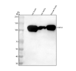 Western blot analysis of TRPV4 using anti-TRPV4 antibody. Lane 1: rat brain tissue lysates, Lane 2: rat testis tissue lysates, Lane 3: mouse brain tissue lysates. After electrophoresis, proteins were transferred to a nitrocellulose membrane at 150 mA for 50-90 minutes. Blocked the membrane with 5% non-fat milk/TBS for 1.5 hour at RT. The membrane was incubated with rabbit anti-TRPV4 antibody at 0.5 ug/ml overnight at 4oC, then washed with TBS-0.1%Tween 3 times with 5 minutes each and probed with a goat anti-rabbit IgG-HRP secondary antibody at a dilution of 1:5000 for 1.5 hour at RT. The signal was developed using enhanced chemiluminescent. Expected molecular weight: 90-110 kDa depending on level of glycosylation.