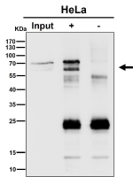 Immunoprecipitation analysis using the antibody at 1:50 dilution. Western blot at 1:1000 dilution. Major bands are observed near 60 kDa and 70 kDa, with the upper species appearing as a doublet, consistent with phosphorylated and unmodified forms of PPP2R5D (predicted ~66 kDa).
