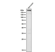 All lanes use the MTOR antibody at 1:500 dilution for 1 hour at room temperature.