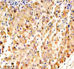 Immunohistochemical staining of OPN5 using anti-OPN5 antibody. OPN5 was detected in a paraffin-embedded section of human liver tissue. Heat mediated antigen retrieval was performed in EDTA buffer (pH 8.0, epitope retrieval solution). The tissue section was blocked with 10% goat serum. The tissue section was then incubated with 2 ug/ml rabbit anti-OPN5 antibody overnight at 4oC. Peroxidase Conjugated Goat Anti-rabbit IgG was used as secondary antibody and incubated for 30 minutes at 37oC. The tissue section was developed using an HRP secondary and DAB substrate.
