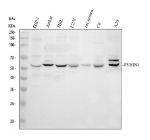 Western blot analysis of PYHIN1 using anti-PYHIN1 antibody. Lane 1: human THP-1 whole cell lysates, Lane 2: human Jurkat whole cell lysates. After electrophoresis, proteins were transferred to a nitrocellulose membrane at 150 mA for 50-90 minutes. Blocked the membrane with 5% non-fat milk/TBS for 1.5 hour at RT. The membrane was incubated with rabbit anti-PYHIN1 antibody at 0.5 ug/ml overnight at 4oC, then washed with TBS-0.1%Tween 3 times with 5 minutes each and probed with a goat anti-rabbit IgG-HRP secondary antibody at a dilution of 1:5000 for 1.5 hour at RT. The signal was developed using enhanced chemiluminescent. A predominant band is detected at ~55 kDa as expected. In A20 and Jurkat lysates the signal appears as a doublet, consistent with modified or isoform variants of PYHIN1 commonly observed for this protein family.