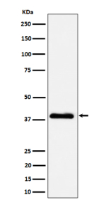 Western blot analysis of NSDHL expression in A431 cell lysate using NSDHL antibody. NSDHL is an ER-associated membrane protein that typically migrates faster on SDS-PAGE due to signal peptide cleavage and altered SDS binding and is commonly observed at ~38 kDa.