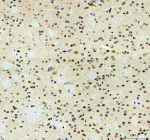 Immunohistochemical staining of MAPK14 using anti- MAPK14 antibody. MAPK14 was detected in a paraffin-embedded section of mouse brain tissue. Heat mediated antigen retrieval was performed in EDTA buffer (pH 8.0, epitope retrieval solution). The tissue section was blocked with 10% goat serum. The tissue section was then incubated with 2 ug/ml rabbit anti- MAPK14 antibody overnight at 4oC. Peroxidase Conjugated Goat Anti-rabbit IgG was used as secondary antibody and incubated for 30 minutes at 37oC. The tissue section was developed using an HRP secondary and DAB substrate.