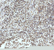 Immunohistochemical staining of IRF2BP1 using anti-IRF2BP1 antibody. IRF2BP1 was detected in a paraffin-embedded section of human tonsil tissue. Heat mediated antigen retrieval was performed in EDTA buffer (pH 8.0, epitope retrieval solution). The tissue section was blocked with 10% goat serum. The tissue section was then incubated with 2 ug/ml rabbit anti-IRF2BP1 antibody overnight at 4oC. Peroxidase Conjugated Goat Anti-rabbit IgG was used as secondary antibody and incubated for 30 minutes at 37oC. The tissue section was developed using an HRP secondary and DAB substrate.