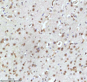 Immunohistochemical staining of IRF2BP1 using anti-IRF2BP1 antibody. IRF2BP1 was detected in a paraffin-embedded section of rat brain tissue. Heat mediated antigen retrieval was performed in EDTA buffer (pH 8.0, epitope retrieval solution). The tissue section was blocked with 10% goat serum. The tissue section was then incubated with 2 ug/ml rabbit anti-IRF2BP1 antibody overnight at 4oC. Peroxidase Conjugated Goat Anti-rabbit IgG was used as secondary antibody and incubated for 30 minutes at 37oC. The tissue section was developed using an HRP secondary and DAB substrate.