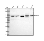 Western blot analysis of SERPINA12 using anti-SERPINA12 antibody. Lane 1: human Hela whole cell lysates, Lane 2: human Jurkat whole cell lysates, Lane 3: human HepG2 whole cell lysates, Lane 4: rat C6 whole cell lysates, Lane 5: mouse B16-F10 whole cell lysates. After electrophoresis, proteins were transferred to a nitrocellulose membrane at 150 mA for 50-90 minutes. Blocked the membrane with 5% non-fat milk/TBS for 1.5 hour at RT. The membrane was incubated with rabbit anti-SERPINA12 antibody at 0.5 ug/ml overnight at 4oC, then washed with TBS-0.1%Tween 3 times with 5 minutes each and probed with a goat anti-rabbit IgG-HRP secondary antibody at a dilution of 1:5000 for 1.5 hour at RT. The signal was developed using enhanced chemiluminescent. A major band is detected at ~55-60 kDa, corresponding to the glycosylated, mature form of SERPINA12 (predicted unglycosylated size ~47 kDa). Glycosylation-dependent size variation is consistent with published data for secreted SERPIN family proteins.