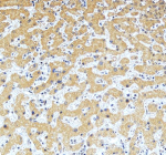 Immunohistochemical staining of SERPINA12 using anti-SERPINA12 antibody. SERPINA12 was detected in a paraffin-embedded section of human liver tissue. Heat mediated antigen retrieval was performed in EDTA buffer (pH 8.0, epitope retrieval solution). The tissue section was blocked with 10% goat serum. The tissue section was then incubated with 2 ug/ml rabbit anti-SERPINA12 antibody overnight at 4oC. Peroxidase Conjugated Goat Anti-rabbit IgG was used as secondary antibody and incubated for 30 minutes at 37oC. The tissue section was developed using an HRP secondary and DAB substrate.