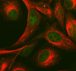 Immunofluorescent staining of FFPE human HeLa cells with MAML1 antibody (green) and Alpha Tubulin mAb (red). HIER: steam section in pH6 citrate buffer for 20 min.