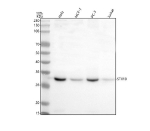 Western blot analysis of Syntaxin 10/STX10 using anti-STX10 antibody. Lane 1: human Hela whole cell lysates, Lane 2: human MCF-7 whole cell lysates, Lane 3: human PC-3 whole cell lysates, Lane 4: human Jurkat whole cell lysates. After electrophoresis, proteins were transferred to a nitrocellulose membrane at 150 mA for 50-90 minutes. Blocked the membrane with 5% non-fat milk/TBS for 1.5 hour at RT. The membrane was incubated with rabbit anti-STX10 antibody at 0.5 ug/ml overnight at 4oC, then washed with TBS-0.1%Tween 3 times with 5 minutes each and probed with a goat anti-rabbit IgG-HRP secondary antibody at a dilution of 1:5000 for 1.5 hour at RT. The signal was developed using enhanced chemiluminescent. The expected molecular weight of Syntaxin 10/STX10 is at 28 kDa.