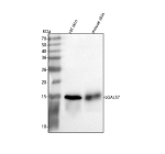 Western blot analysis of Galectin-7/LGALS7 using anti-LGALS7/7B antibody. Lane 1: rat skin tissue lysates, Lane 2: mouse skin tissue lysates. After electrophoresis, proteins were transferred to a nitrocellulose membrane at 150 mA for 50-90 minutes. Blocked the membrane with 5% non-fat milk/TBS for 1.5 hour at RT. The membrane was incubated with rabbit anti-LGALS7/7B antibody at 0.5 ug/ml overnight at 4oC, then washed with TBS-0.1%Tween 3 times with 5 minutes each and probed with a goat anti-rabbit IgG-HRP secondary antibody at a dilution of 1:5000 for 1.5 hour at RT. The signal was developed using enhanced chemiluminescent. A specific band was detected for Galectin-7/LGALS7 at approximately 15 kDa. The expected molecular weight of Galectin-7/LGALS7 is at 15 kDa.