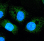 Immunofluorescent staining of TIGAR using anti-TIGAR antibody (green). TIGAR was detected in an immunocytochemical section of cells. Enzyme antigen retrieval was performed using IHC enzyme antigen retrieval reagent for 15 mins. The cells were blocked with 10% goat serum. And then incubated with 5 ug/ml rabbit anti-TIGAR antibody overnight at 4oC. DyLight 488 Conjugated Goat Anti-Rabbit IgG was used as secondary antibody at 1:500 dilution and incubated for 30 minutes at 37oC. The section was counterstained with DAPI nuclear stain (blue). Visualize using a fluorescence microscope and filter sets appropriate for the label used.