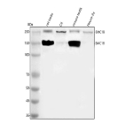 Western blot analysis of SMC1B using anti-SMC1B antibody. Lane 1: rat testis tissue lysates, Lane 2: rat C6 whole cell lysates, Lane 3: mouse testis tissue lysates, Lane 4: mouse Neuro-2a whole cell lysates. After electrophoresis, proteins were transferred to a nitrocellulose membrane at 150 mA for 50-90 minutes. Blocked the membrane with 5% non-fat milk/TBS for 1.5 hour at RT. The membrane was incubated with rabbit anti-SMC1B antibody at 0.5 ug/ml overnight at 4oC, then washed with TBS-0.1%Tween 3 times with 5 minutes each and probed with a goat anti-rabbit IgG-HRP secondary antibody at a dilution of 1:5000 for 1.5 hour at RT. The signal was developed using enhanced chemiluminescent. A major band is detected at ~150 kDa consistent with full-length SMC1B, with an additional band near ~250 kDa that likely represents an SDS-resistant SMC1B-containing complex or dimer enriched in testis.