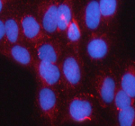 Immunofluorescent staining of SMC1B using anti-SMC1B antibody (red). SMC1B was detected in an immunocytochemical section of U2OA cells. Enzyme antigen retrieval was performed using IHC enzyme antigen retrieval reagent for 15 mins. The cells were blocked with 10% goat serum. And then incubated with 5 ug/ml rabbit anti-SMC1B antibody overnight at 4oC. Cy3 Conjugated Goat Anti-Rabbit IgG was used as secondary antibody at 1:500 dilution and incubated for 30 minutes at 37oC. The section was counterstained with DAPI nuclear stain (blue). Visualize using a fluorescence microscope and filter sets appropriate for the label used.