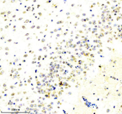 Immunohistochemical staining of RIM1/RIMS1 using anti-RIM1/RIMS1 antibody. RIMS1 was detected in a paraffin-embedded section of rat brain tissue. Heat mediated antigen retrieval was performed in EDTA buffer (pH 8.0, epitope retrieval solution). The tissue section was blocked with 10% goat serum. The tissue section was then incubated with 2 ug/ml rabbit anti-RIMS1 antibody overnight at 4oC. Peroxidase Conjugated Goat Anti-rabbit IgG was used as secondary antibody and incubated for 30 minutes at 37oC. The tissue section was developed using an HRP secondary and DAB substrate.