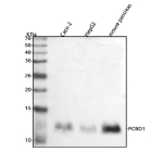 Western blot analysis of PCBD1 using anti-PCBD1 antibody. Lane 1: human Caco-2 whole cell lysates, Lane 2: human HepG2 whole cell lysates, Lane 3: mouse pancreas tissue lysates. After electrophoresis, proteins were transferred to a nitrocellulose membrane at 150 mA for 50-90 minutes. Blocked the membrane with 5% non-fat milk/TBS for 1.5 hour at RT. The membrane was incubated with rabbit anti-PCBD1 antibody at 0.5 ug/ml overnight at 4oC, then washed with TBS-0.1%Tween 3 times with 5 minutes each and probed with a goat anti-rabbit IgG-HRP secondary antibody at a dilution of 1:5000 for 1.5 hour at RT. The signal was developed using enhanced chemiluminescent. A specific band was detected for PCBD1 at approximately 12 kDa. The expected molecular weight of PCBD1 is ~12 kDa.