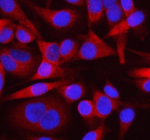 Immunofluorescent staining of OTUD3 using anti-OTUD3 antibody (red). OTUD3 was detected in an immunocytochemical section of HELA cells. Enzyme antigen retrieval was performed using IHC enzyme antigen retrieval reagent for 15 mins. The cells were blocked with 10% goat serum. And then incubated with 5 ug/ml rabbit anti-OTUD3 antibody overnight at 4oC. Cy3 Conjugated Goat Anti-Rabbit IgG was used as secondary antibody at 1:500 dilution and incubated for 30 minutes at 37oC. The section was counterstained with DAPI nuclear stain (blue). Visualize using a fluorescence microscope and filter sets appropriate for the label used.