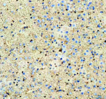 Immunohistochemical staining of Aldolase C/ALDOC using anti-ALDOC antibody. Aldolase C/ALDOC was detected in a paraffin-embedded section of rat brain tissue. Heat mediated antigen retrieval was performed in EDTA buffer (pH 8.0, epitope retrieval solution). The tissue section was blocked with 10% goat serum. The tissue section was then incubated with 2 ug/ml rabbit anti-ALDOC antibody overnight at 4oC. Peroxidase Conjugated Goat Anti-rabbit IgG was used as secondary antibody and incubated for 30 minutes at 37oC. The tissue section was developed using an HRP secondary and DAB substrate.