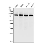 All lanes use the PKC delta/theta Antibody at 1:1000 dilution for 1 hour at room temperature. Predicted molecular weight: 68-82 kDa.