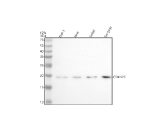 Western blot analysis of CDKN2C using anti-CDKN2C antibody. Lane 1: human THP-1 whole cell lysates, Lane 2: human Hela whole cell lysates, Lane 3: human Jurkat whole cell lysates, Lane 4: human SH-SY5Y whole cell lysates. After electrophoresis, proteins were transferred to a nitrocellulose membrane at 150 mA for 50-90 minutes. Blocked the membrane with 5% non-fat milk/TBS for 1.5 hour at RT. The membrane was incubated with rabbit anti-CDKN2C antibody at 0.5 ug/ml overnight at 4oC, then washed with TBS-0.1%Tween 3 times with 5 minutes each and probed with a goat anti-rabbit IgG-HRP secondary antibody at a dilution of 1:5000 for 1.5 hour at RT. The signal was developed using enhanced chemiluminescent. A specific band was detected for CDKN2C at approximately 18 kDa. The expected molecular weight of CDKN2C is ~18 kDa.