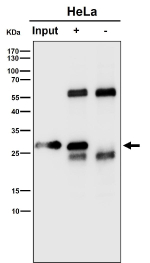 Immunoprecipitation analysis using the RPS8 antibody at 1:50 dilution. Western blot at 1:1000 dilution. A specific band is enriched at ~26 kDa in the antibody IP and absent in the control IP, consistent with post-translationally modified RPS8 running slightly above its predicted ~24 kDa.