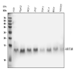 Western blot analysis of NDUFAB1 using anti-NDUFAB1 antibody. Lane 1: human whole cell lysates, Lane 2: human HepG2 whole cell lysates, Lane 3: human MCF-7 whole cell lysates, Lane 4: human 293T whole cell lysates, Lane 5: human THP-1 whole cell lysates, Lane 6: human PC-3 whole cell lysates, Lane 7: rat RH35 whole cell lysates, Lane 8: mouse NIH/3T3 whole cell lysates. After electrophoresis, proteins were transferred to a nitrocellulose membrane at 150 mA for 50-90 minutes. Blocked the membrane with 5% non-fat milk/TBS for 1.5 hour at RT. The membrane was incubated with rabbit anti-NDUFAB1 antibody at 1:500 overnight at 4oC, then washed with TBS-0.1%Tween 3 times with 5 minutes each and probed with a goat anti-rabbit IgG-HRP secondary antibody at a dilution of 1:500 for 1.5 hour at RT. The signal was developed using enhanced chemiluminescent. A specific band at ~14 kDa is observed, consistent with the mature, mitochondrial NDUFAB1 generated after transit-peptide cleavage and bearing the 4'-phosphopantetheine modification.