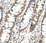 Immunohistochemical staining of PEX1 using anti-PEX1 antibody. PEX1 was detected in a paraffin-embedded section of human colon tissue. Heat mediated antigen retrieval was performed in EDTA buffer (pH 8.0, epitope retrieval solution). The tissue section was blocked with 10% goat serum. The tissue section was then incubated with 2 ug/ml rabbit anti-PEX1 antibody overnight at 4oC. Peroxidase Conjugated Goat Anti-rabbit IgG was used as secondary antibody and incubated for 30 minutes at 37oC. The tissue section was developed using an HRP secondary and DAB substrate.