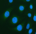 Immunofluorescent staining of PIK3C2A using anti-PIK3C2A antibody (green). PIK3C2A was detected in an immunocytochemical section of Hela cells. Enzyme antigen retrieval was performed using IHC enzyme antigen retrieval reagent for 15 mins. The cells were blocked with 10% goat serum. And then incubated with 5 ug/ml rabbit anti-PIK3C2A antibody overnight at 4oC. DyLight 488 Conjugated Goat Anti-Rabbit IgG was used as secondary antibody at 1:500 dilution and incubated for 30 minutes at 37oC. Visualize using a fluorescence microscope and filter sets appropriate for the label used.
