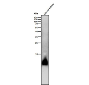 Mouse kidney tissue lysate tested with the Phospho-Phospholamban (S16) antibody at 1:2000 dilution for 1 hour at room temperature. A specific band is detected near ~10 kDa, consistent with the phosphorylated form of monomeric Phospholamban. The apparent size exceeds its 6 kDa theoretical mass due to its hydrophobic, multimeric nature and phosphorylation-dependent gel mobility.